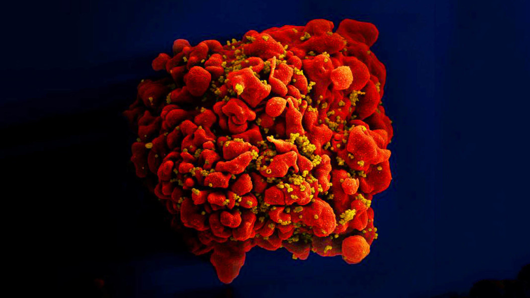 rapid-news-rapidnews-Lab-produced-antibody-new-hope-in-HIV-fight-dailyrapidnews