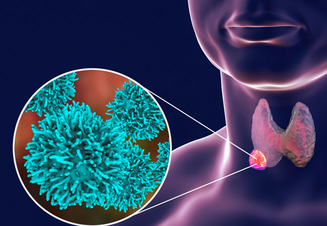 Too-much-light-at-night-may-raise-odds-for-thyroid-cancer-study-says-rapidnews-dailyrapid-dailyrapidnews-pakistan