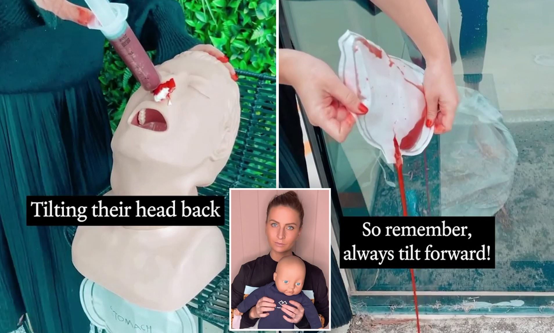 Medic-reveals-why-you-should-NEVER-tip-a-childs-head-back-during-a-nosebleed-rapid-news-rapidnews-dailyrapid