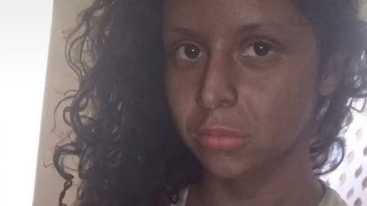 Student's fake tan fail leaves her 'looking like mahogany dining