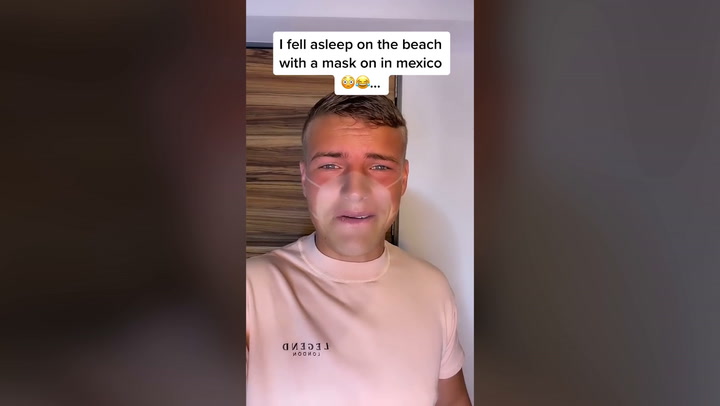 Man left in hysterics after claiming he suffered tanning fail after falling alseep on beach