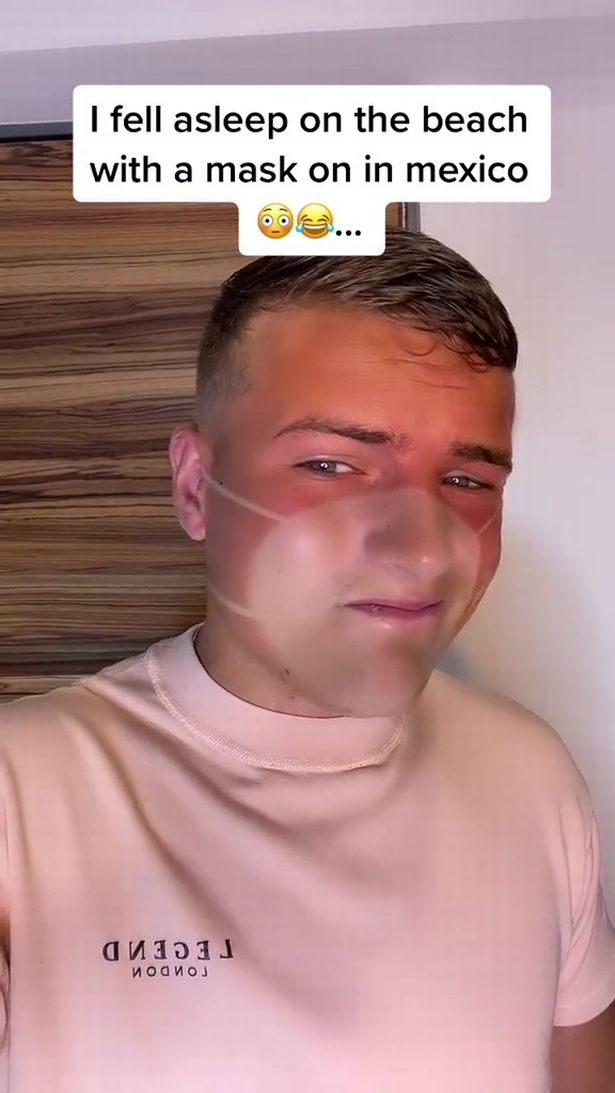 Man-fools-TikTok-with-hilarious-fake-tan-mishap-but-its-not-what-you-think-rapidnews-dailyrapid