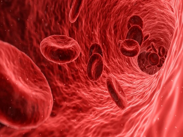 Reports Suggest COVID-19 Triggering Recurrent Blood Clots in Arms