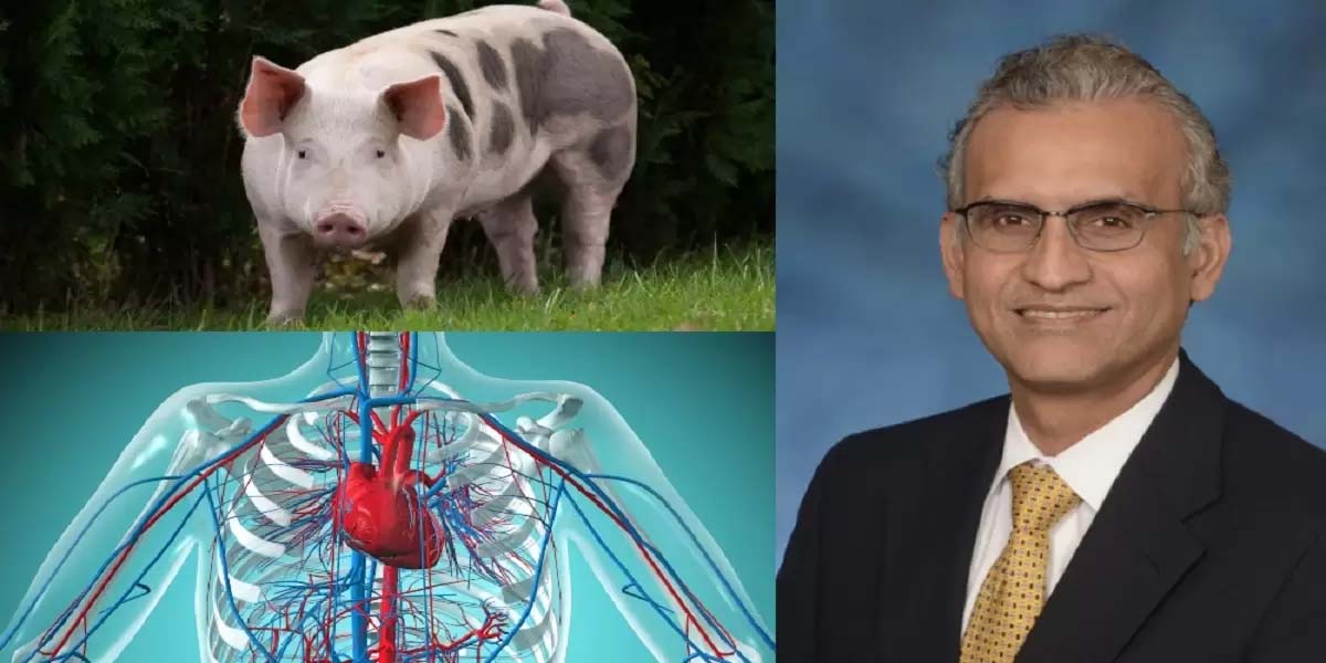 Pakistani doctor made history by transplanting a pig’s heart into a Human