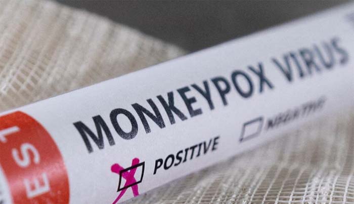 Sixth case of Monkeypox reported in Pakistan